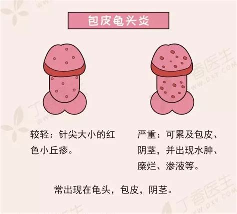 龜頭黑黑|龜頭有黑斑是怎麼回事